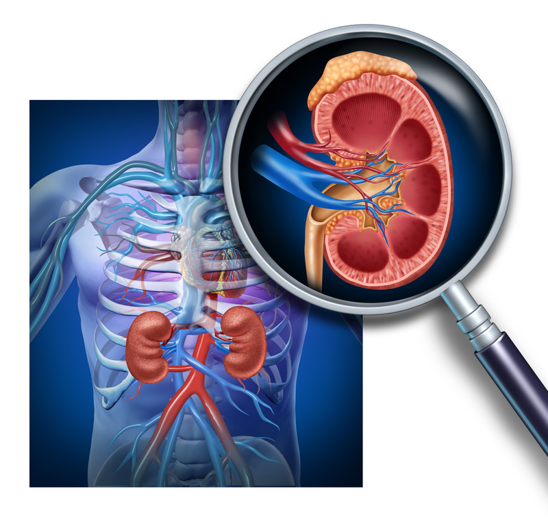 Image of the kidney in an internal diagram | Kidney Disease | BLOG POST | Comfort Keepers Vancouver